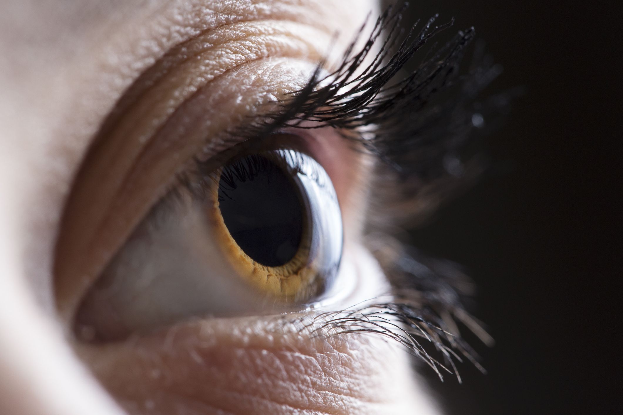 brown eye Brown eye – Steven J. Covici, MD, FACS